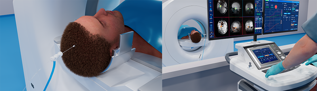 Surgical Procedure