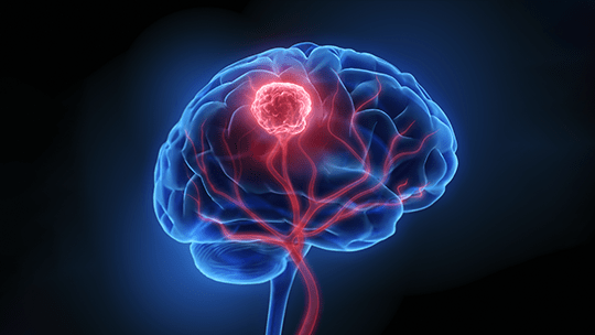 Neuron Network